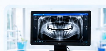 AI dental X-ray screening